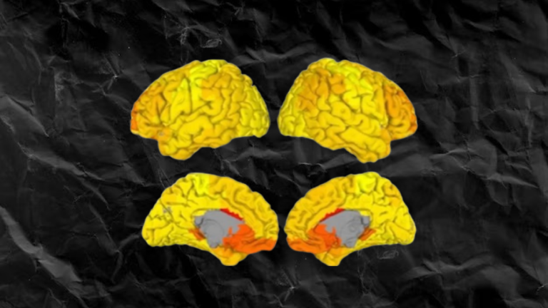 Brain Imaging for Emotion Understanding